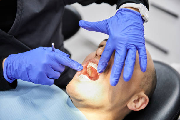 Best Emergency Dental Care for Broken or Chipped Teeth in Daniels Farm, CT