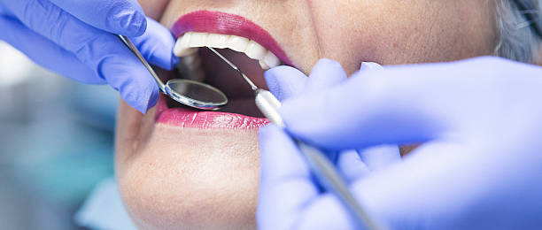 Best Emergency Dental Care for Broken or Chipped Teeth in Daniels Farm, CT